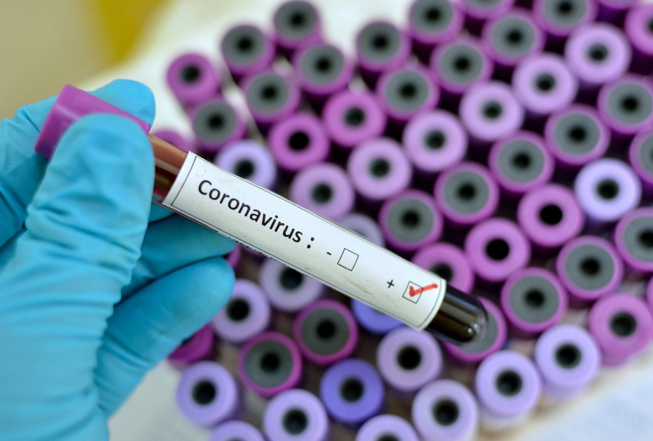 Chapecó confirma três casos de coronavírus