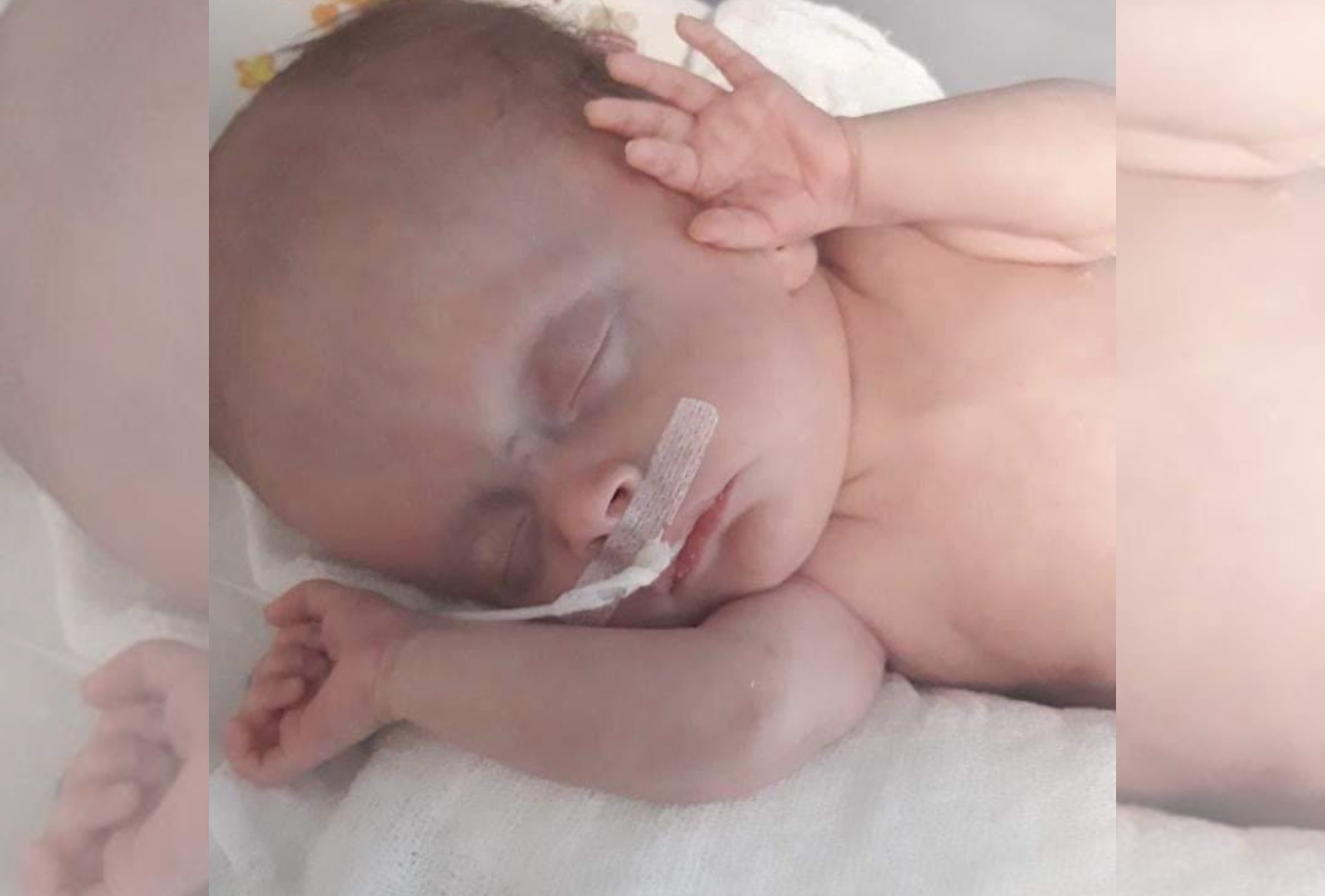 Família de Seara organiza ação solidária para custear tratamento de bebê com hidrocefalia